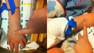 Infusing Factor with Butterfly Needle - 1 & 2