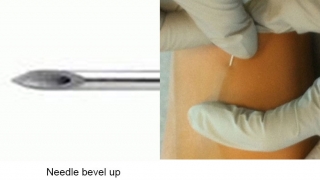 Infusing Factor with Butterfly Needle - 4 & 5