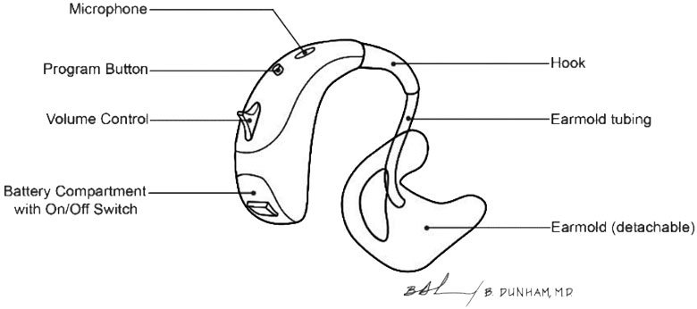 Hearing Aid
