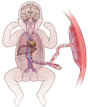 Fetus/baby with less oxygen delivery