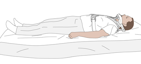 • Tuck the side flaps under the back part of the CTO.