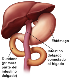 Vista frontal del hígado y el estómago donde puede verse el intestino delgado conectado al hígado después de un procedimiento de Kasai.