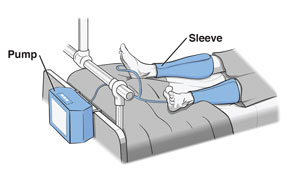 Sequential compression device with sleep and pump labeled.