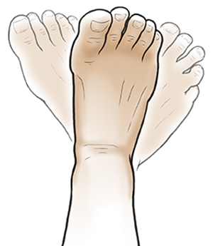 To help with healing, you may be instructed to draw the letters of the alphabet in the air with your feet. Foot with ghosted-in positions showing foot rotating.