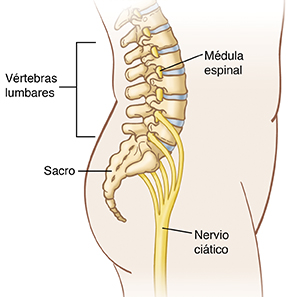 Contorno de la vista lateral de un cuerpo en el que puede verse la posición de la médula espinal, las vértebras lumbares, el sacro y el nervio ciático.