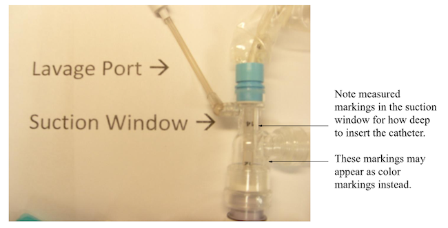 How To Suction A Tracheostomy